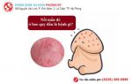 Mụn LiTi Ở Bao Quy Đầu. Phái Mạnh Nên Nhận Biết Ngay Căn Bệnh Này