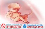 Bỏ Thai 18 Tuần Tuổi - Hướng Dẫn Bỏ Thai 18 Tuần Tuổi An Toàn