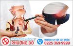 Cắt Trĩ Hết Bao Nhiêu Tiền?