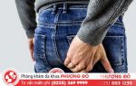 Cách chữa bệnh trĩ an toàn chỉ với 1 liệu trình