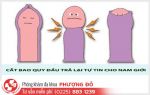 Giá cắt bao quy đầu hiện nay là bao nhiêu?