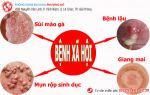 Nguyên Nhân Bệnh Xã Hội Do Đâu Dẫn Đến. Anh Chị Cùng Tham Khảo Bài Viết