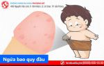 Ngứa bao quy đầu là bị bệnh gì? Có nguy hiểm không?