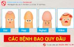 Tổng quan bệnh bao quy đầu