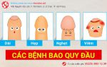 Bạn có chắc mình đã biết hết các bệnh về bao quy đầu?