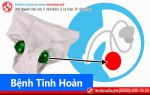 Những bệnh tinh hoàn thường gặp và cách hỗ trợ điều trị hiệu quả