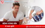 Các bệnh vùng kín ở nam giới không nên bỏ qua