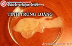 Tinh trùng loãng vì “yêu” quá nhiều?