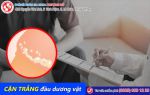 Phát hiện cặn trắng đầu dương vật khiến nam giới sửng sốt