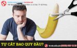 Cắt bao quy đầu tại nhà có được không?