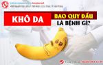 Khô da bao quy đầu là bệnh gì?