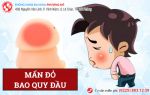 [Chú ý] Mẩn đỏ bao quy đầu báo hiệu bệnh nguy hiểm