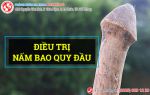 Hết nấm bao quy đầu nhờ phương pháp tiên tiến