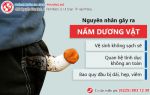 Bệnh nấm dương vật là gì?