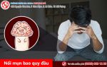 Nổi mụn bao quy đầu, kiểm tra ngay xem bạn đang mắc bệnh gì