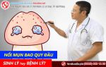 Nổi mụn bao quy đầu: Sinh lý hay bệnh lý?