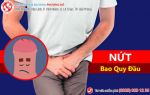 Nứt bao quy đầu, quý ông “đổ xô” đi tìm “thủ phạm”