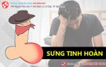 Sưng tinh hoàn - dấu hiệu cảnh báo bệnh nguy hiểm