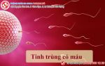 Nói không nên lời, chịu tiếng “trăng hoa” vì tinh trùng có lẫn máu