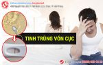 Tinh trùng vón cục – BÁO ĐỘNG sức khỏe sinh sản nam giới