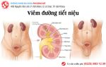 Khó khăn “ập đến” chỉ vì viêm đường tiết niệu