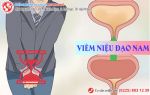 Viêm niệu đạo nam giới chớ dại mà xem thường