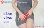 Các bệnh vùng kín phổ biến nhất hiện nay - Chị em nên cảnh giác