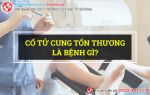 Cổ tử cung tổn thương, dấu hiệu nhiều bệnh nguy hiểm