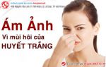 Thận trọng khi huyết trắng có màu, mùi hôi và ngứa