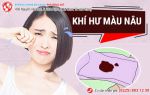 Khí hư  màu nâu: Nguy hiểm khôn lường hay không đáng lo ngại?