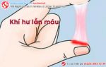 Nguy cơ mắc nhiều bệnh nguy hiểm khi khí hư có lẫn máu