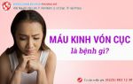 Nhiều bệnh phụ khoa nguy hiểm qua dấu hiệu máu kinh vón cục