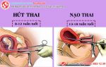 Lành ít dữ nhiều khi nạo hút thai ở phòng khám chui