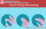 Nhận biết nhanh các dấu hiệu huyết trắng bất thường