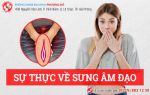 Sự thật gây shock về tình trạng sưng âm đạo