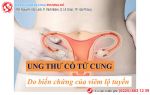 Phát hiện viêm lộ tuyến cổ tử cung sớm, đẩy lùi ung thư hiệu quả