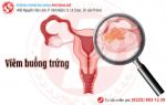 Truy tìm nguyên nhân viêm buồng trứng ở nữ