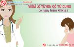 Viêm cổ tử cung có nguy hiểm không? Điều trị như thế nào?