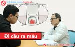 Lý do khiến bạn không thể bỏ qua hiện tượng đi cầu ra máu