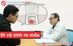 Đi vệ sinh ra máu là dấu hiệu của bệnh gì?