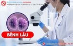 Tất cả những thông tin xoay quanh bệnh lậu