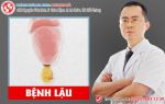 Bệnh lậu nam và những tiết lộ bất ngờ