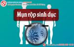 Tổng quan về mụn rộp sinh dục