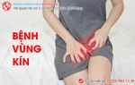 Bệnh vùng kín – nỗi lo không chỉ của nữ giới