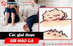 Giai Đoạn Sùi Mào Gà. Nói Lên Sức Khỏe Của Anh Chị