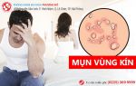 Cách chữa mụn vùng kín và địa chỉ chữa trị uy tín bạn nên biết