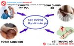 GÓC GIẢI ĐÁP: Sùi mào gà có lây không?