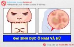 Gai sinh dục và những điều cần biết