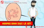 Cùng tìm hiểu về bệnh herpes sinh dục