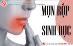 Hình ảnh trực quan mụn rộp sinh dục nam và nữ